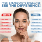 Anti Acne Face Wash by divinetatva.in 1